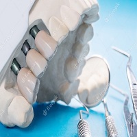 видове зъбни импланти - 32203 типа
